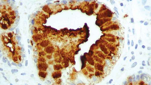 Reagente anticorpo monoclonale - PA0424-U - Leica Biosystems - per istopatologia / diagnostico / per tessuti