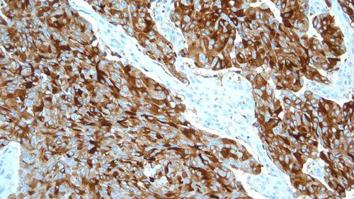 Reagente anticorpo - PA0406-U - Leica Biosystems - anticorpo policlonale / di tessuti paraffinati (FFPE) / diagnostico
