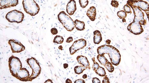Reagente anticorpo - PA0416-U - Leica Biosystems - anticorpo monoclonale / per istopatologia / per immunoistochimica