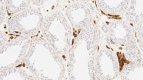 Reagente anticorpo - CALRET566-L-CE - Leica Biosystems - anticorpo monoclonale / diagnostico / per immunoistochimica