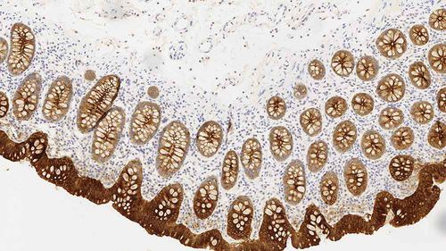 Reagente anticorpo - CEA-609-L-CE - Leica Biosystems - anticorpo monoclonale / per immunoistochimica / diagnostico