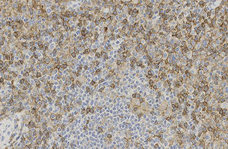 Reagente anticorpo monoclonale - CD4 - Leica Biosystems - anticorpo / per istopatologia / per immunoistochimica
