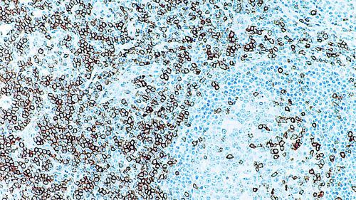 Reagente anticorpo - CD5 - Leica Biosystems - anticorpo monoclonale / per immunoistochimica / per istopatologia