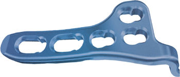 Placca di compressione per clavicola - ORTHO CARE - laterale / bloccata / in metallo