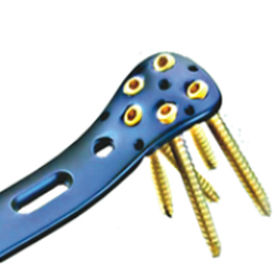 Placca di compressione per femore - ORTHO CARE - prossimale / in metallo