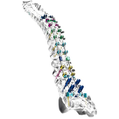 Sistema di osteosintesi toraco-lombare - INERTIA® - Nexxt Spine - via posteriore / per adulti