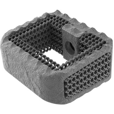 Gabbia intersomatica cervicale - NEXXT MATRIXX® - Nexxt Spine - via anteriore / in titanio
