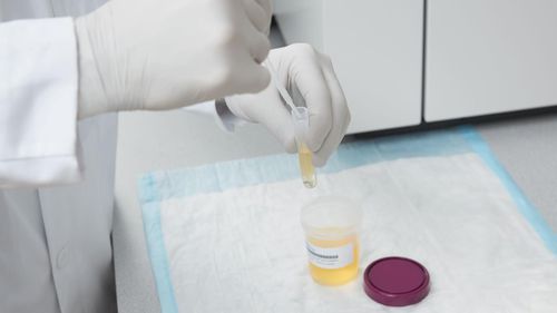 Kit di test per il fentanil - ARK™  - Siemens Healthineers - Laboratory Diagnostics - di sostanze stupefacenti / di urina