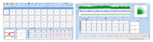 Software di analisi - CardioTrak  - Beneware Medical Equipment - per Holter cardiaco / medico