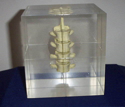 Phantom di calibrazione per radiografia - RS-1400 - Radiology Support Devices - di rachide