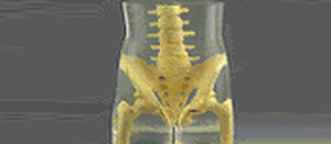 Phantom di calibrazione per radiografia - RS-113T - Radiology Support Devices - di pelvi