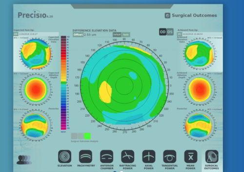 Software di analisi - iVerify® - iVis Technologies - di verifica / medico / per chirurgia oftalmica