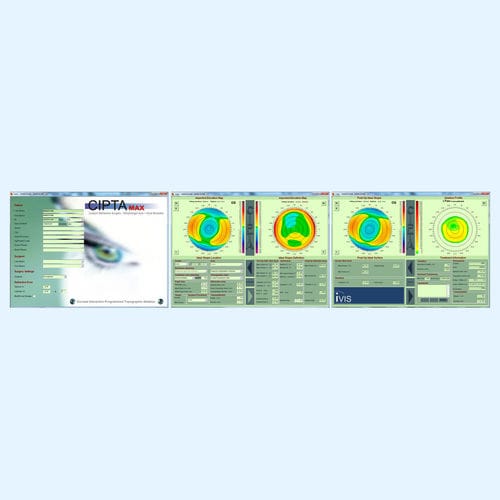Software di pianificazione del trattamento - CIPTA® - iVis Technologies - di pianificazione preoperatoria / di progettazione / medico
