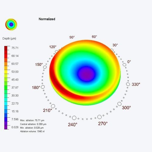 Modulo software medico - PresbyMAX® - SCHWIND eye-tech-solutions - per oftalmologia / di pianificazione del trattamento / di occhio