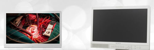 Monitor medico - Etkin Medical Devices - per sala operatoria / chirurgico / Full HD