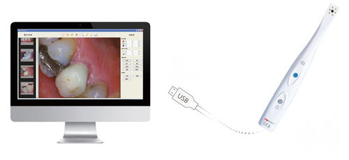 Fotocamera intraorale - SuperVista-----HDI-210 - Handy Technologies - digitale / CMOS / USB
