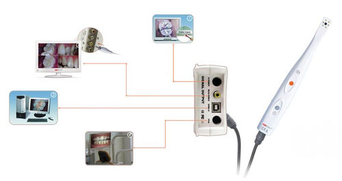 Fotocamera intraorale - CamAssist-----HDI-300/400A - Handy Technologies - digitale / CCD