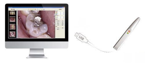 Fotocamera intraorale - EzCam - Handy Technologies - digitale / CMOS