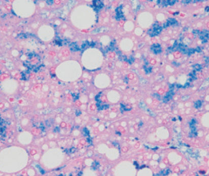 Reagente soluzione colorante - Perls - BIO-OPTICA Milano - per istologia / per citologia