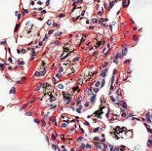 Reagente soluzione colorante - Sirius Red - BIO-OPTICA Milano - per citologia / per istologia