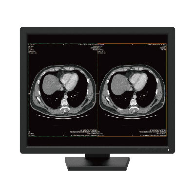 Monitor medico - R191 - Nanjing Jusha Display Technology - diagnostico / 1280 x 1024 / 19"