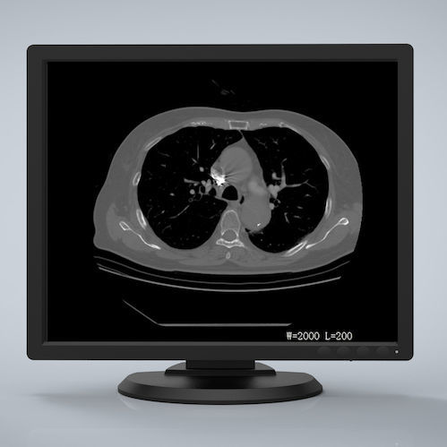 Monitor medico - R193G - Nanjing Jusha Display Technology - 1280 x 1024 / LCD / LED