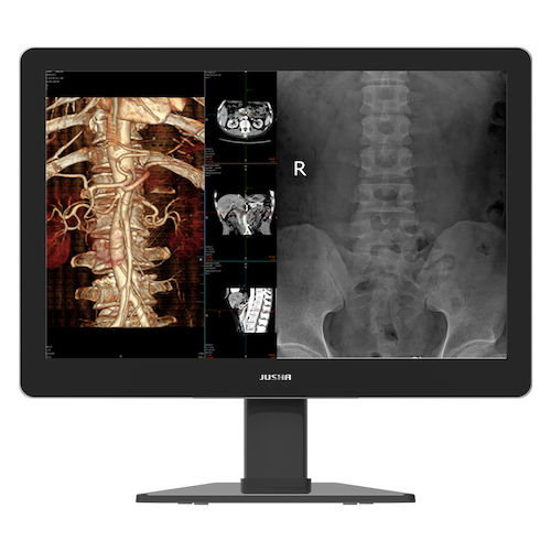 Monitor medico - C630G - Nanjing Jusha Display Technology - diagnostico / per mammografia / ad alta definizione