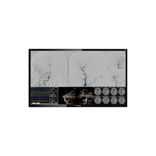Monitor medico - E550EG - Nanjing Jusha Display Technology - per sala operatoria / per endoscopia / 3840 × 2160