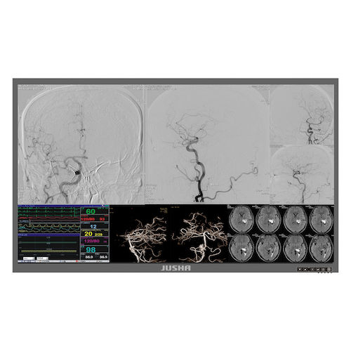 Monitor medico - S5810 - Nanjing Jusha Display Technology - chirurgico / 3840 × 2160 / 58"