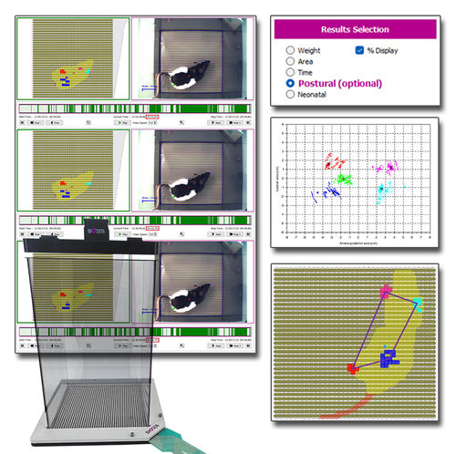 Software medico - BIO-DWB2-POSTUR - Bioseb - da laboratorio / di analisi / di orecchio interno