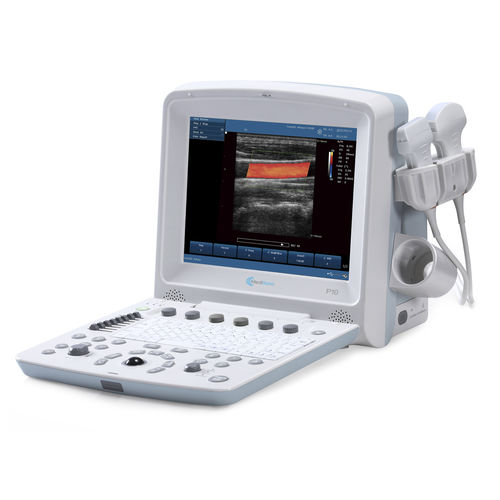 Ecografo portatile - P10 - MediSono - per ecografia multidisciplinare / con console integrata