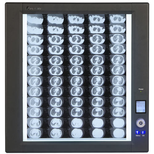 Negativoscopio digitale - Trimline - Wolf X-Ray Corporation - 1 corpo / 2 corpi / 4 corpi
