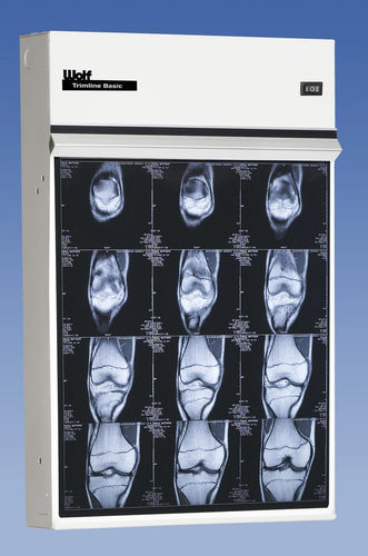 Negativoscopio tradizionale - Trimline Basic - Wolf X-Ray Corporation - multisezione