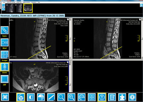 Software per radiologia - iQ-VIEW/PRO - IMAGE Information Systems - per medicina nucleare / per reportistica / di visualizzazione
