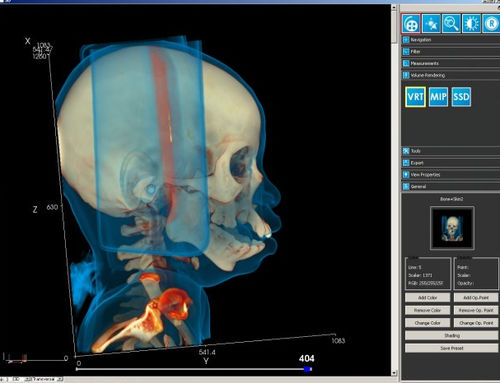 Modulo software per diagnostica per immagini - iQ-3D - IMAGE Information Systems - di visualizzazione 3D / di post elaborazione / per tablet PC