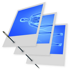 Software per imaging ortopedico - Stitching  - IMAGE Information Systems - per imaging veterinario / di gestione dati / di acquisizione