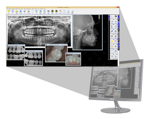 Software di visualizzazione - LED Dental - di analisi / per imaging odontoiatrico / odontoiatrico
