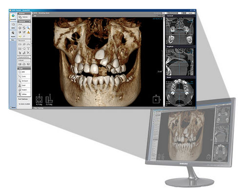 Software di visualizzazione 3D - Xelis 3D - LED Dental - di analisi / per imaging odontoiatrico / odontoiatrico