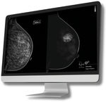 software medicale per tomosintesi mammaria