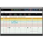 simulatore per monitor fetali