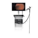 videogastroscopio grandangolo