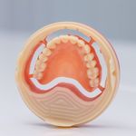 modello anatomico gengivale