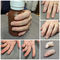 protesi estetica di ditoLifelikeMedical Art Prosthetics