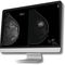 software medicale per tomosintesi mammariaBreast-SlimView&reg;Hera-MI