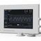 sistema di monitoraggio escursione diaframmaticaRESPINOR DXTRespinor DXT