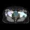 piattaforma AI medicaVarian Oncology
