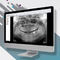 software di visualizzazioneOMSCarestream Dental