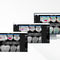 software di visualizzazionePearl's Second Opinion&reg;Carestream Dental