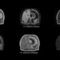 software medico4D MR-RTPhilips Healthcare