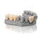 materiale odontoiatrico per stampa 3DVarseoSmile&reg; TriniQ&reg;BEGO